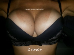 2 anos