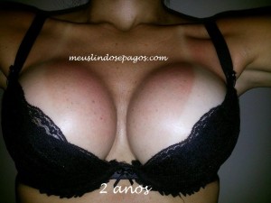 2 anos4