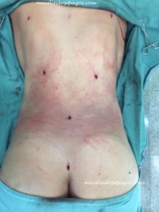 10799424_557857597650184_102715319_n