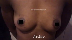 antes