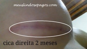 cica 2 meses (2)
