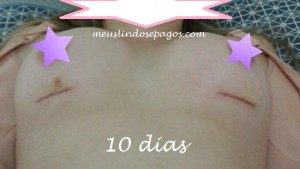 10dias