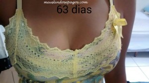 63dias (3)