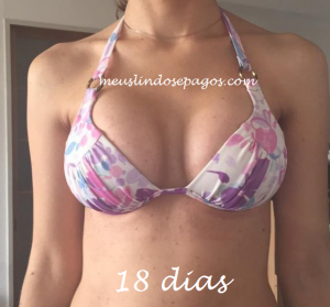 18dias (1)