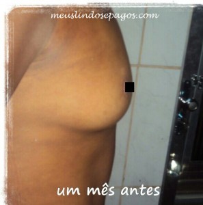 antes2