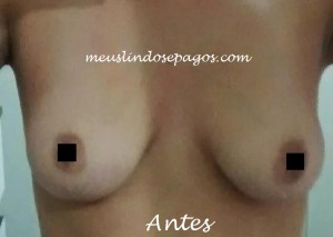 antes