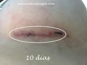 10dias2