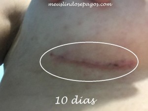 10dias3