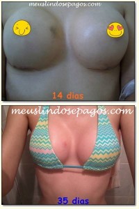 14dias1