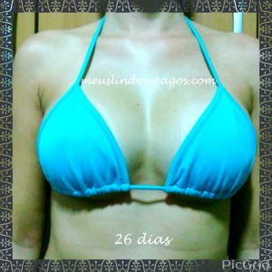 26dias