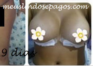 9dias seios