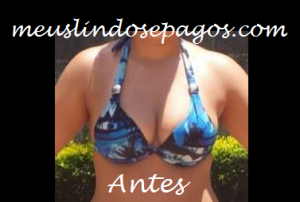 antes seios