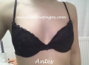 antes1
