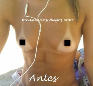 antes2