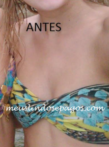 antes2