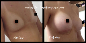 montagem