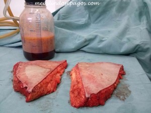 11042675_646097505521707_3671099890172987609_n