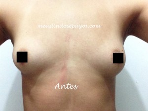 11358774_10204343329963539_2147115617_n