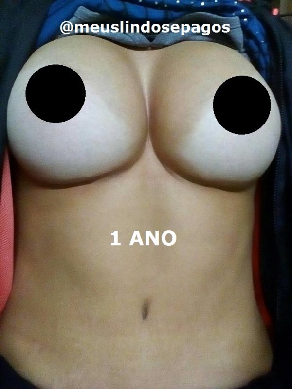 1ano-1