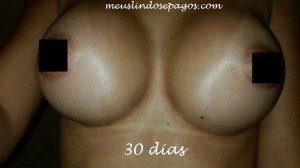 30dias1