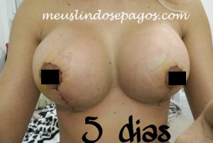 5dias