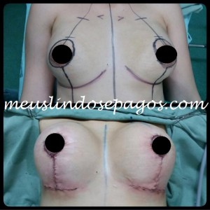 11292668_888837251187602_1714332275_n