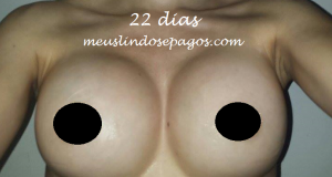 22dias2