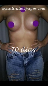 70 dias