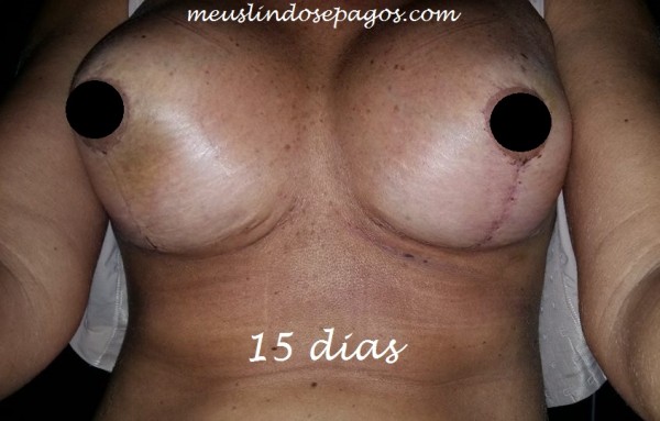 15dias3