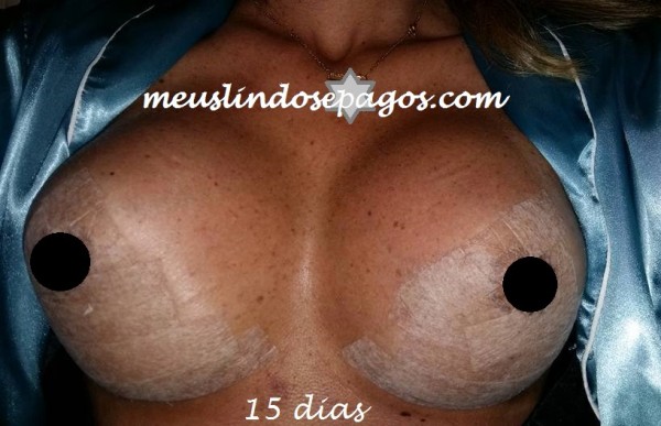 15dias