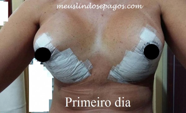1dia