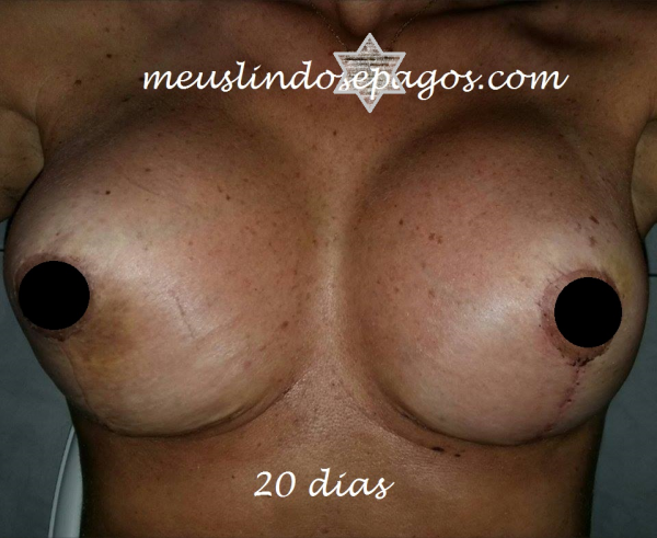 20dias1