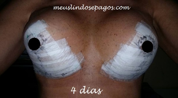 4dias