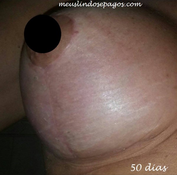 50dias1