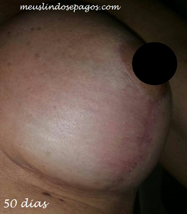 50dias2