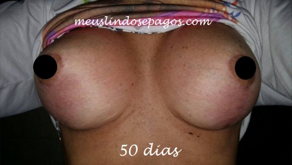 50dias