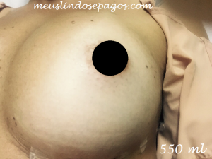 550ml5
