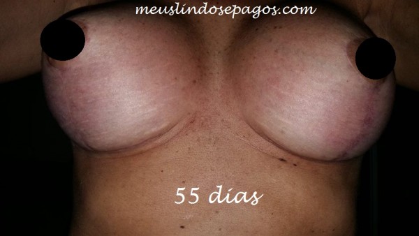 55dias1