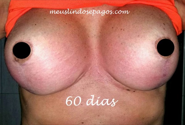 60dias