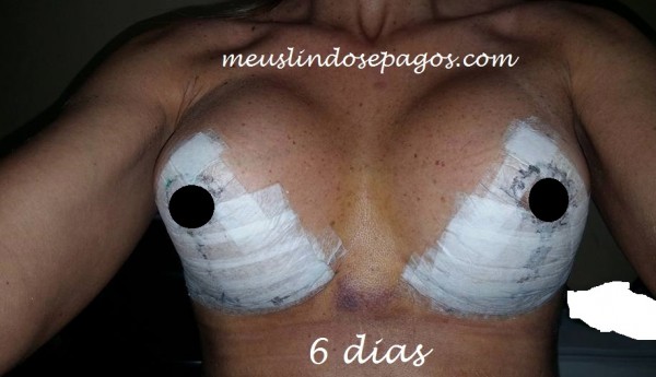 6dias