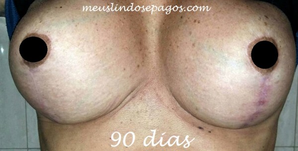 90dias