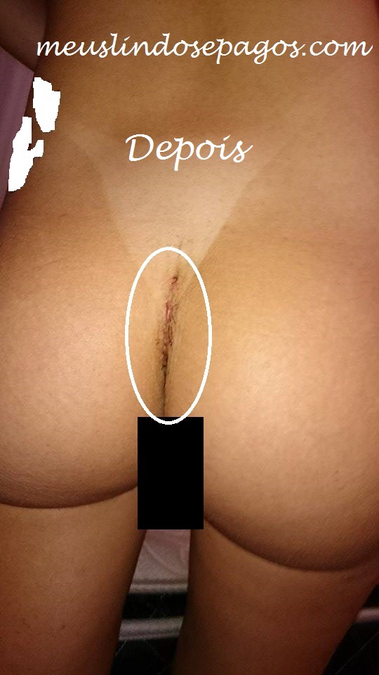depois5