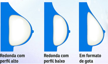 perfil e formato4