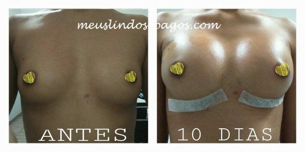 antes e 10-1