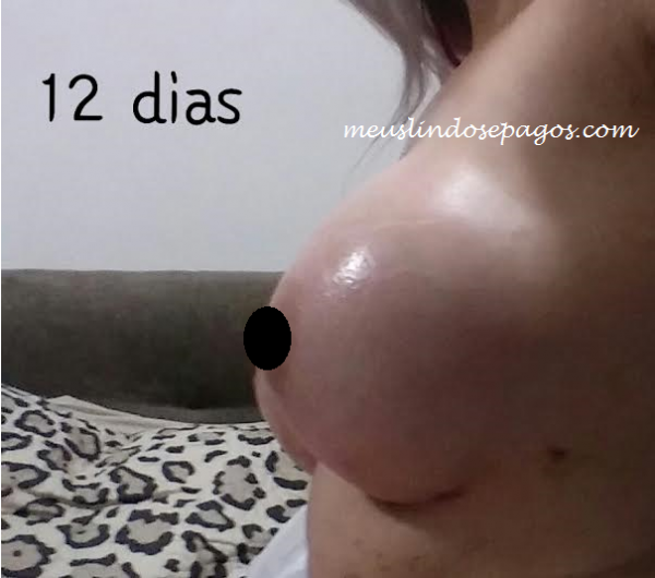 12dias1