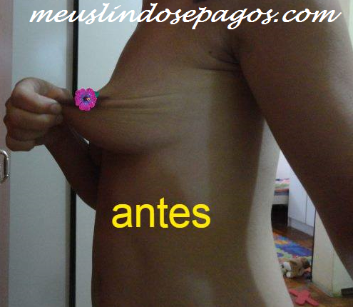 antes4