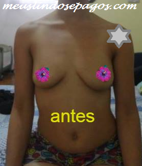 antes6