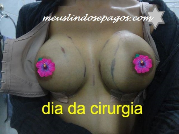 dia da cirurgia3-1