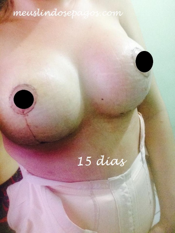 15dias