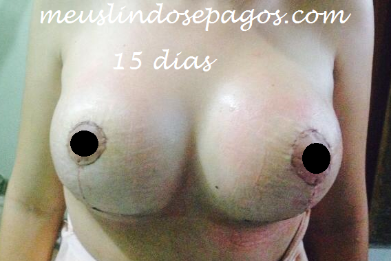 15dias2